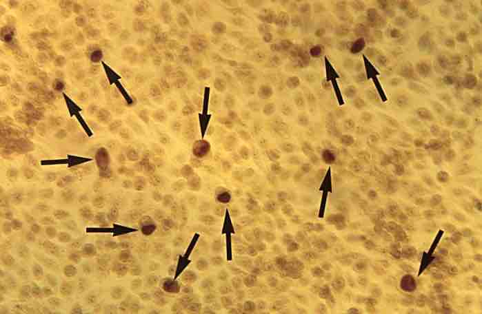 Chlamydia Stain