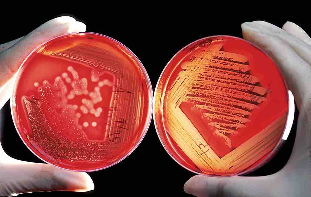 Microbial pathogen growing on blood-agar plate