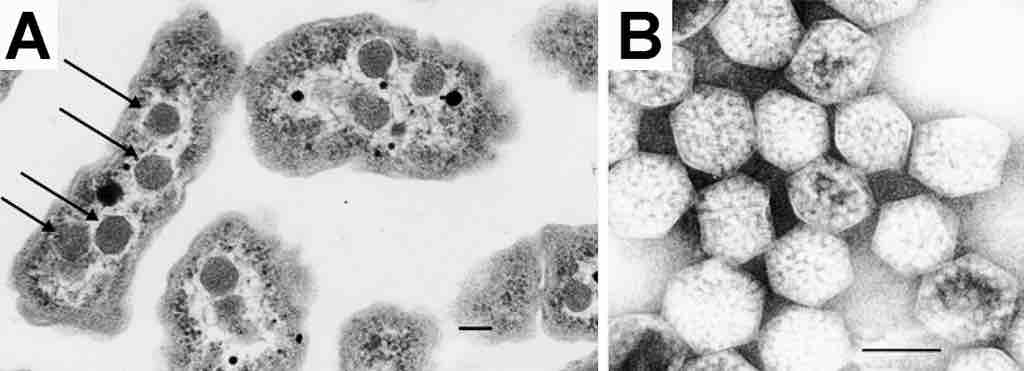 Electron Micrograph of a carboxysome