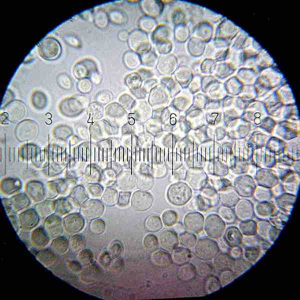 Saccharomyces cerevisiae