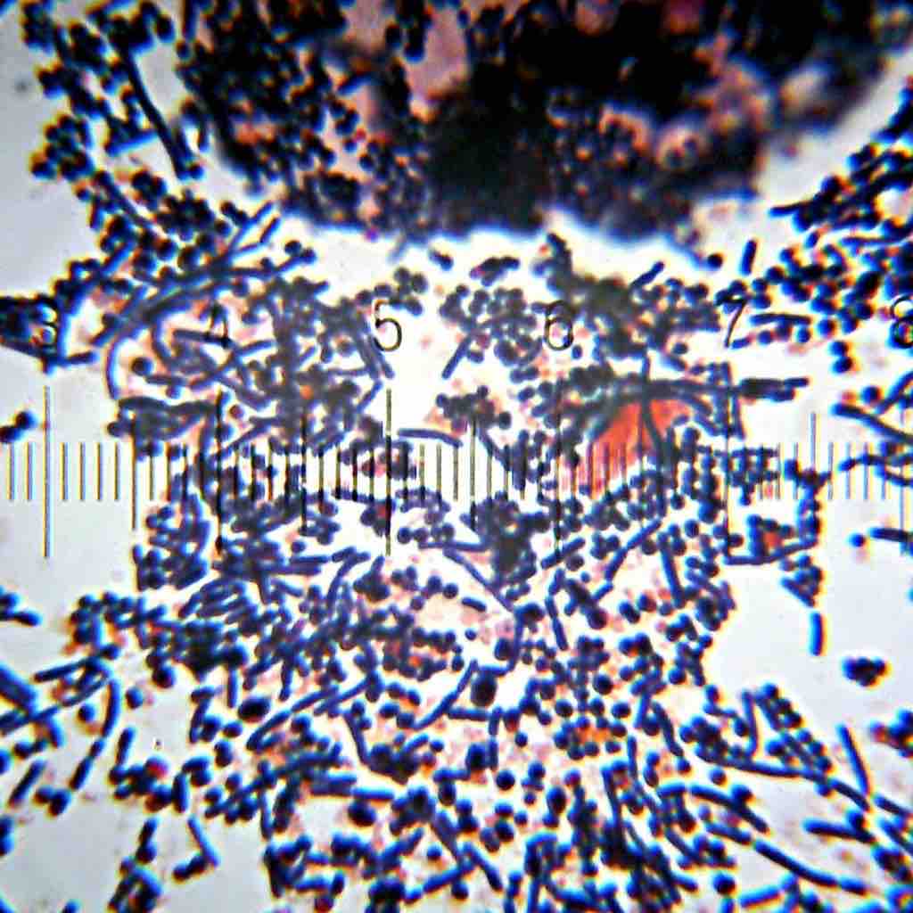 Gram-positive bacteria