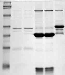 Immunoblot