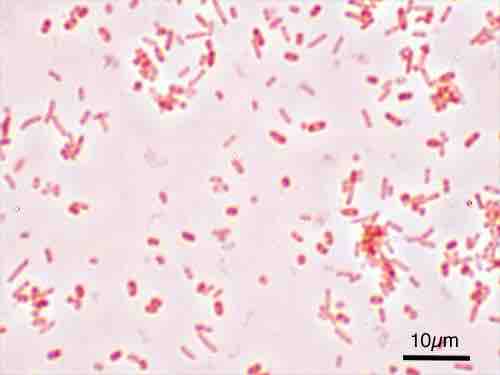 Salmonella Typhimurium