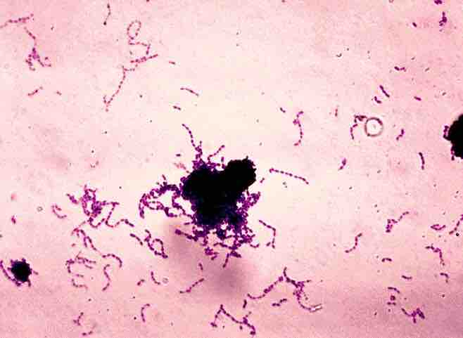 Gram stain of Streptococcus mutans.