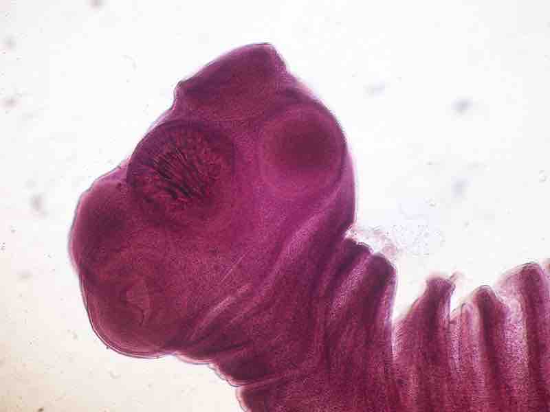 Scolex of the Taenia solium