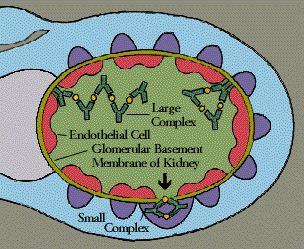 Immune Complex Diseases