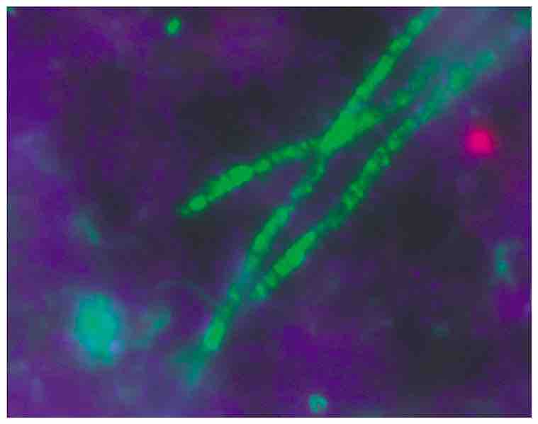 Acdiobacterium