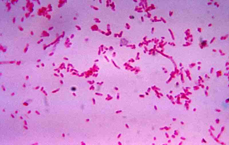 Fusobacterium novum