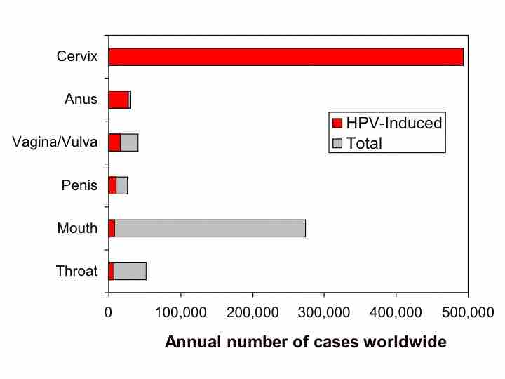 Virus Causing Cervical Cancer