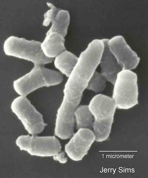 Scanning electron micrograph of Rhodococcus sp. strain Q1