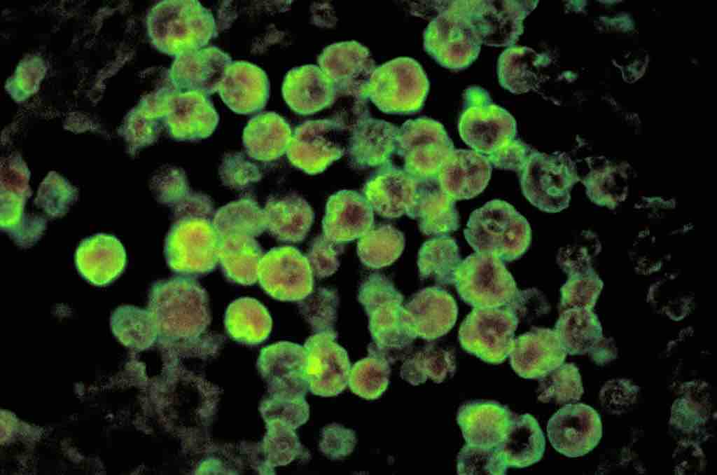 Naegleria fowleri