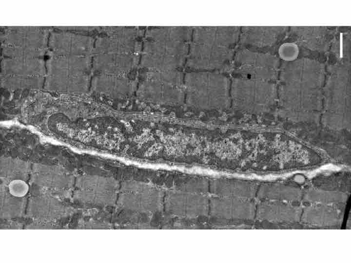 Skeletal Satellite Muscle Cell