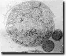 Nanoarchaeum equitans