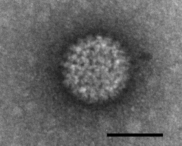 TEM of the Bluetongue virus