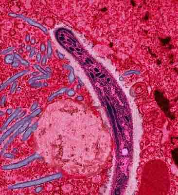 The malaria plasmodium