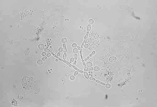 Candida albicans