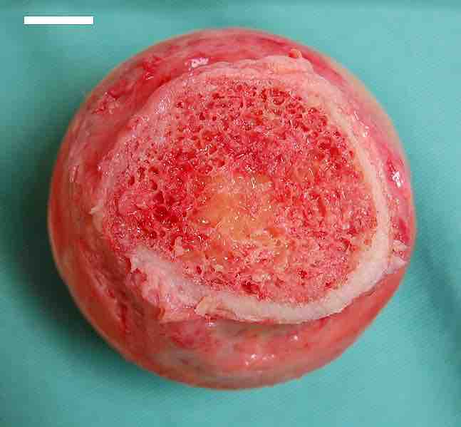 Femur head showing trabecular bone