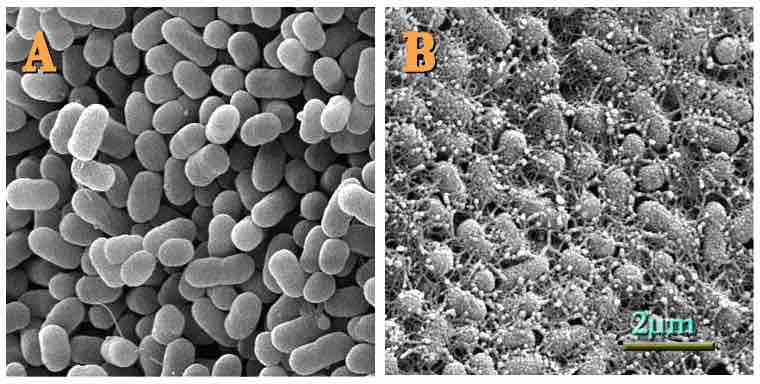 Escherichia coli O157:H7