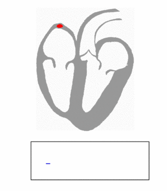 525px ecg principle slow