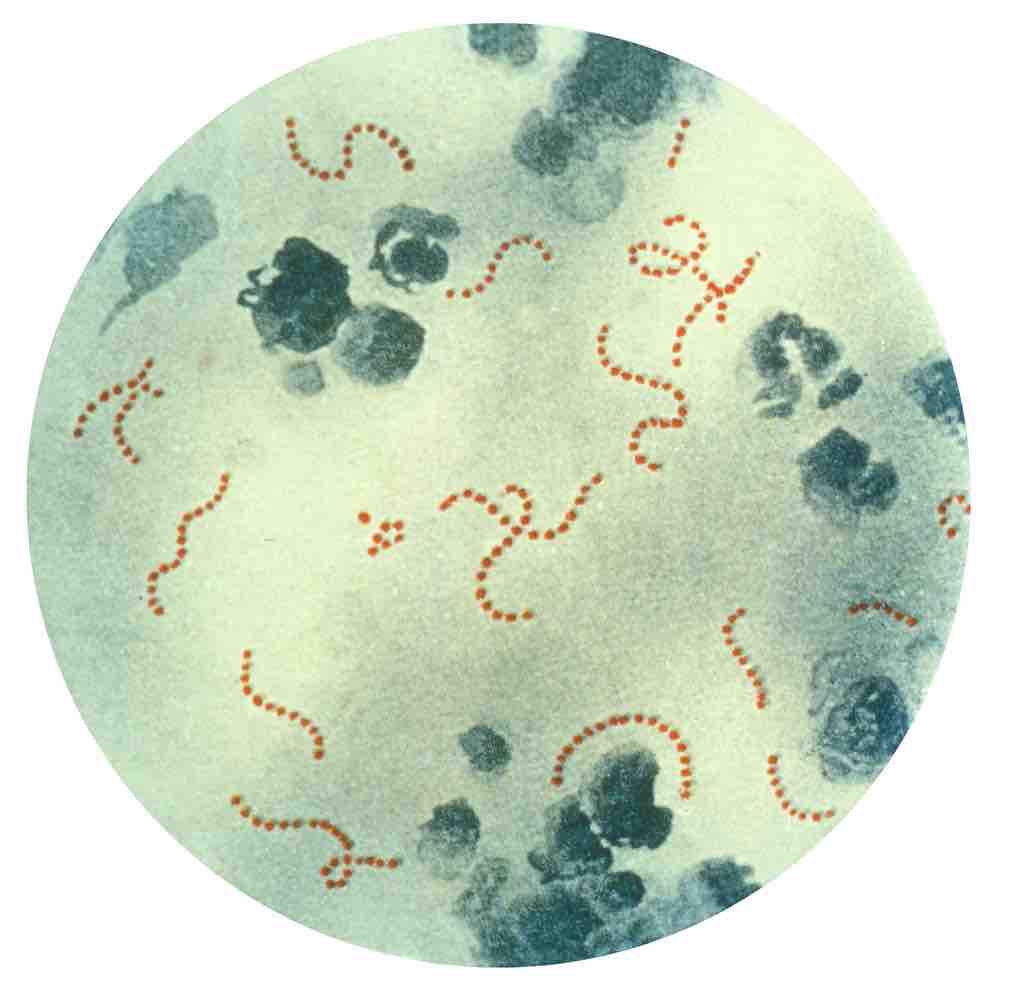 Streptococcus pyogenes bacteria