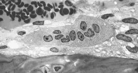 Osteoclast