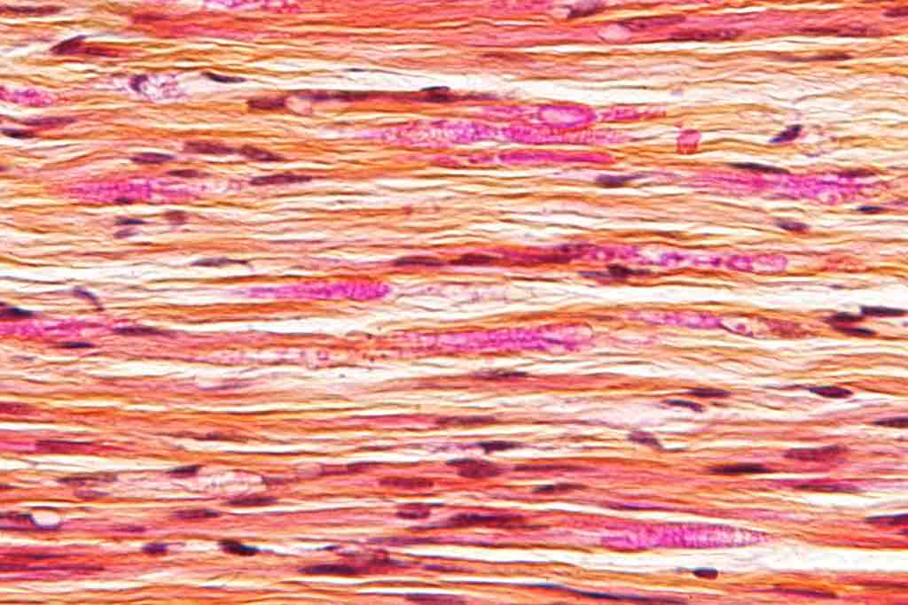 Nerve injury