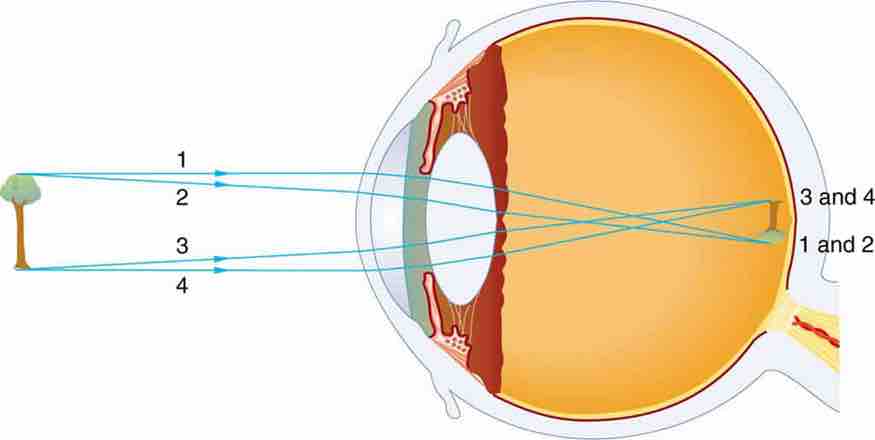 Vision Diagram