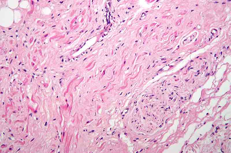 Sinoatrial Node Tissue