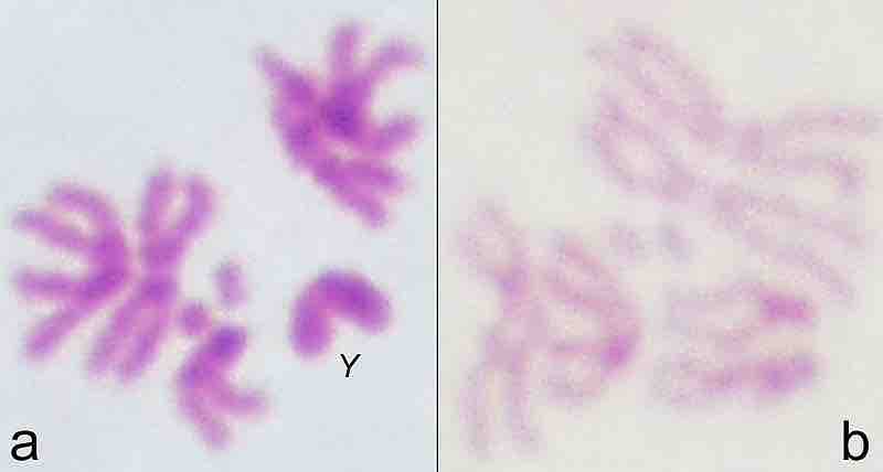 Human chromosome structure