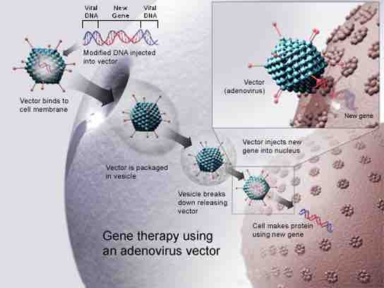 Gene Therapy