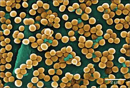 MRSA, a superbug