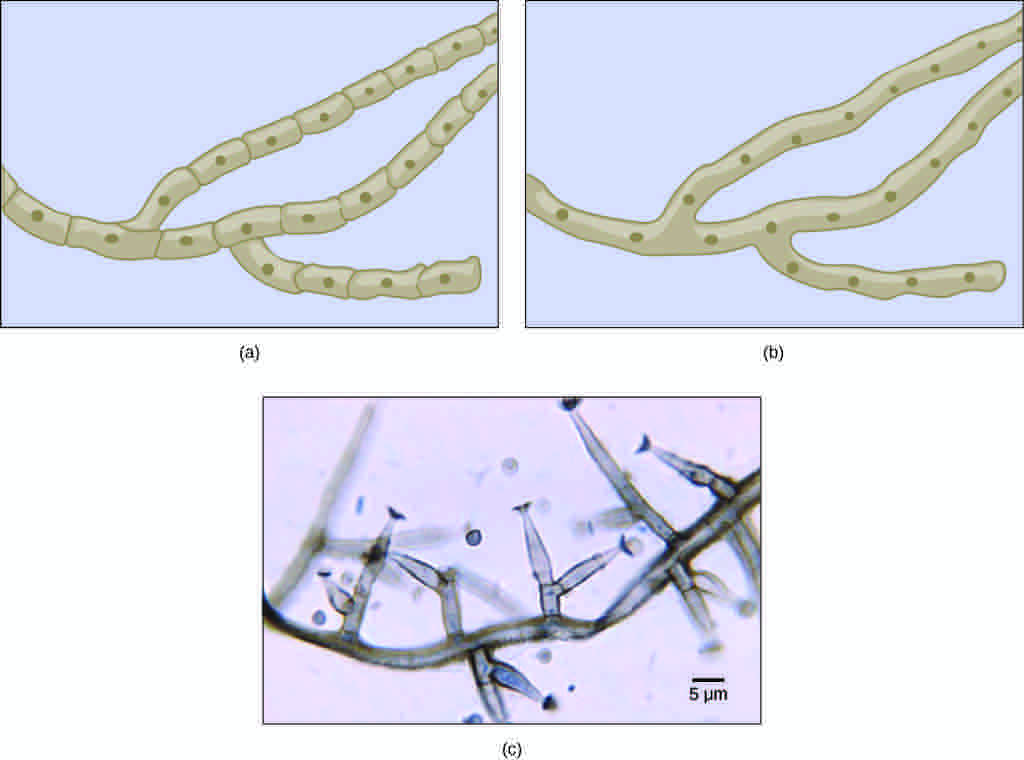 Division of hyphae into separate cells