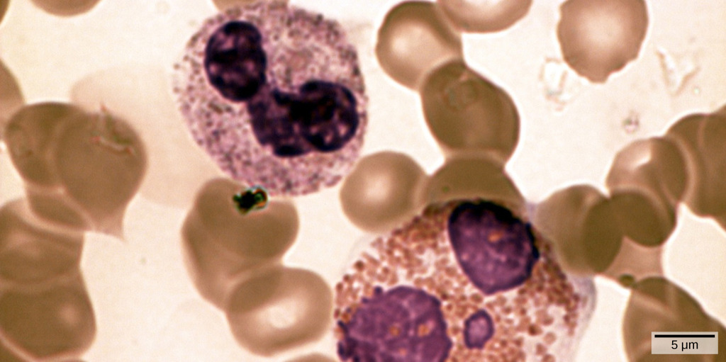 Neutrophils and eosinophils