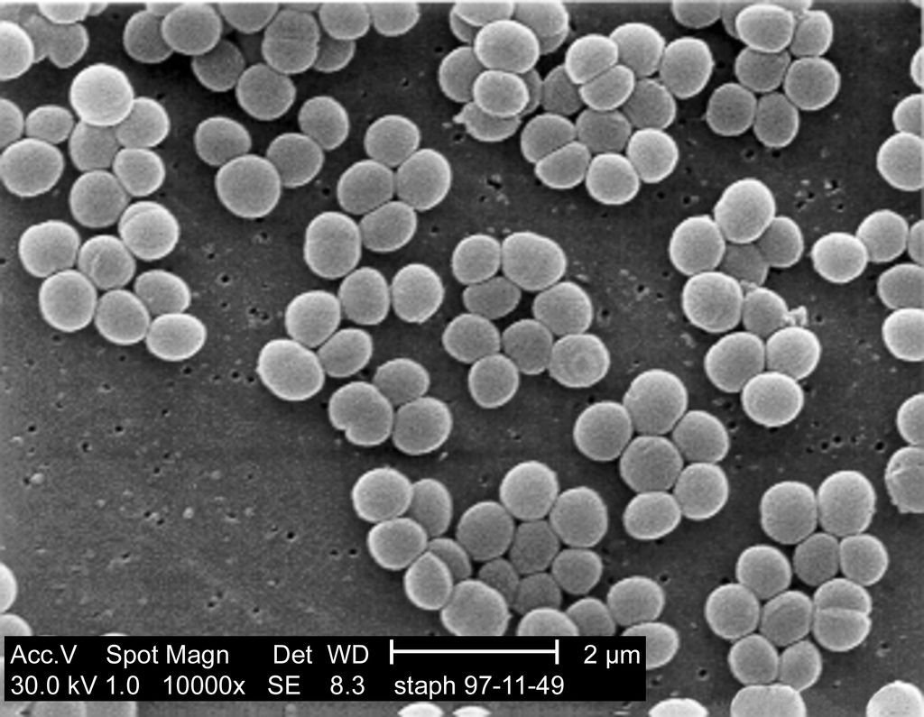 Staphylococcus aureus