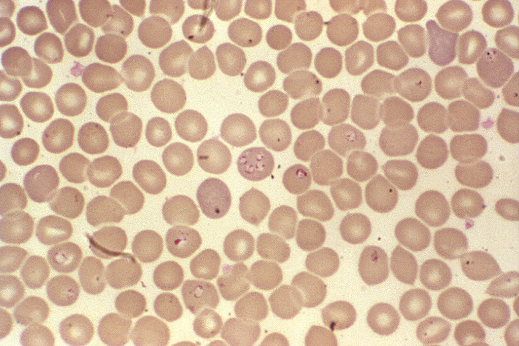 Babesia parasites