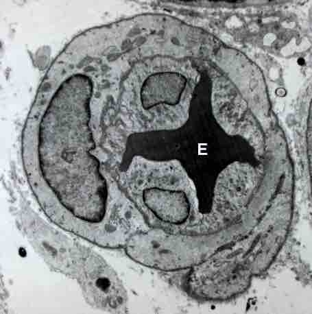 Angiogenesis Generates New Blood Vessels