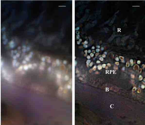 Aging Tissue and Vision Loss