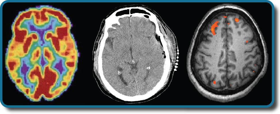 Brain-imaging techniques