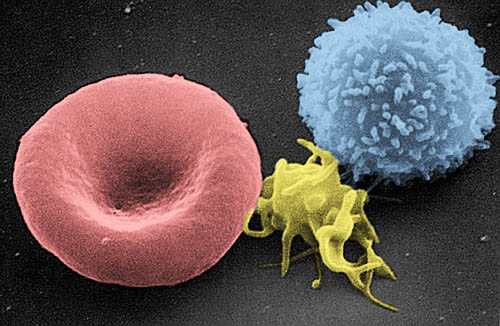 Scanning electron micrograph of blood cells