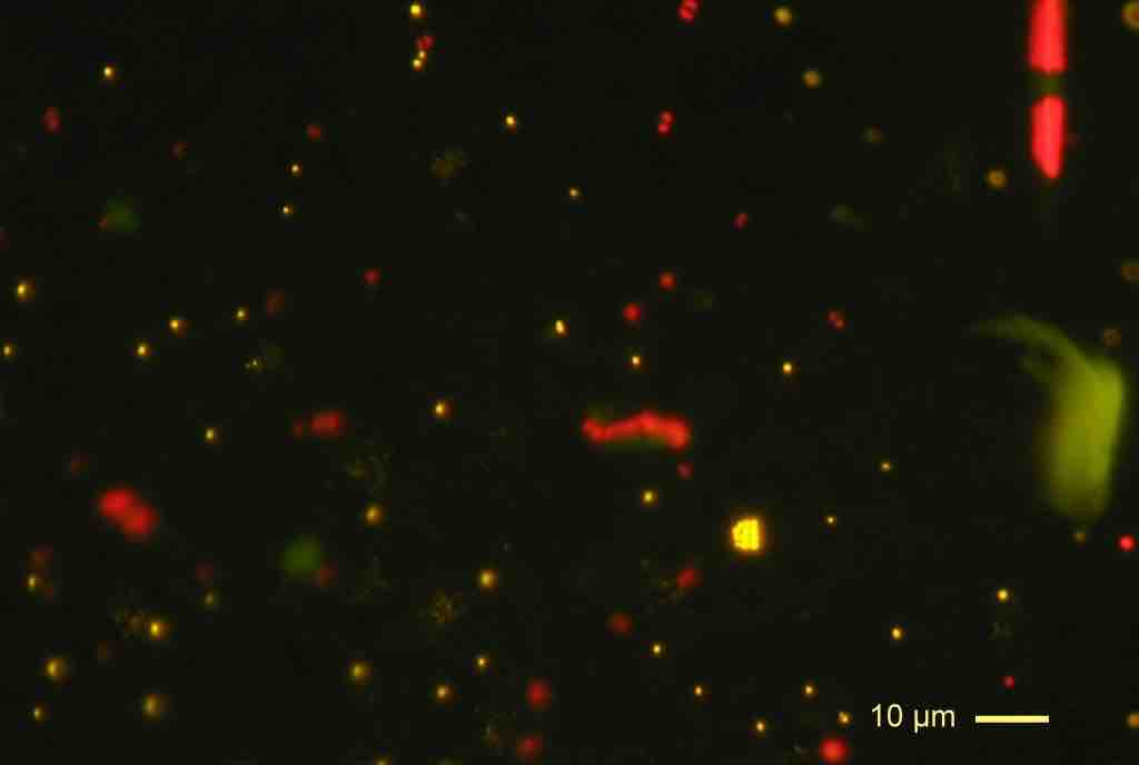 Prokaryotes vs. Eukaryotes