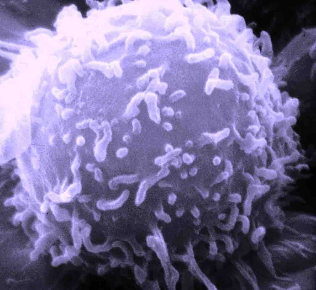 Lymphocyte