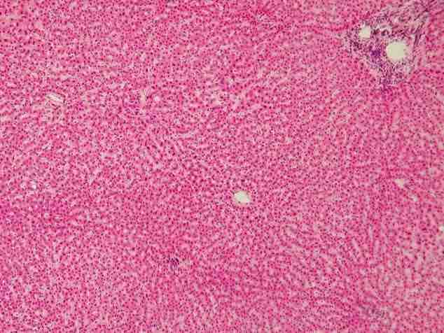 Hepatocytes