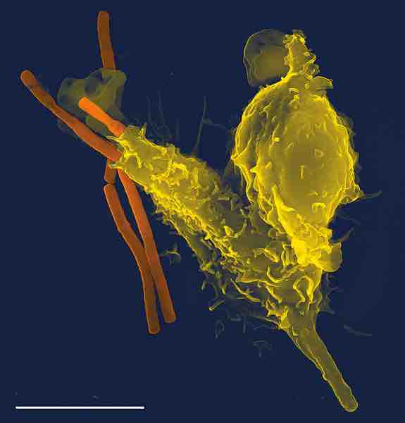 A Phagocyte in Action