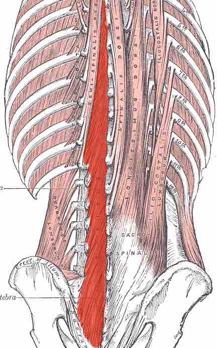 Location of the multifidus muscle