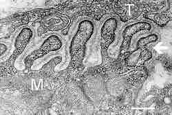 Figure 2. Neuromuscular junction