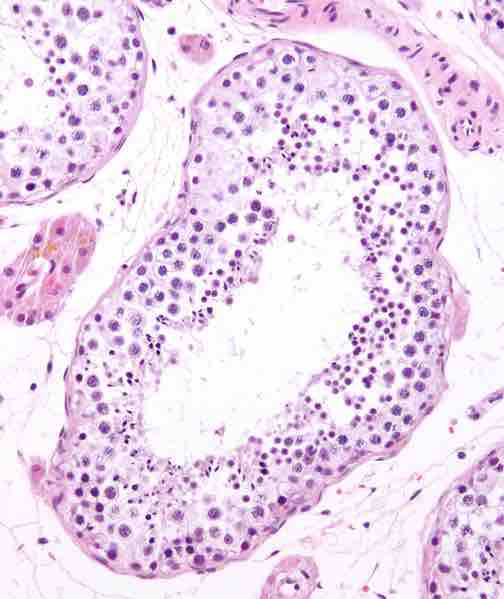 Histiological Representation of Seminferious Tubules