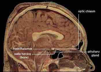 Location of the hypothalamus