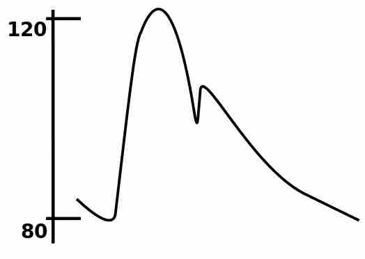 Changes in Arterial Pressure