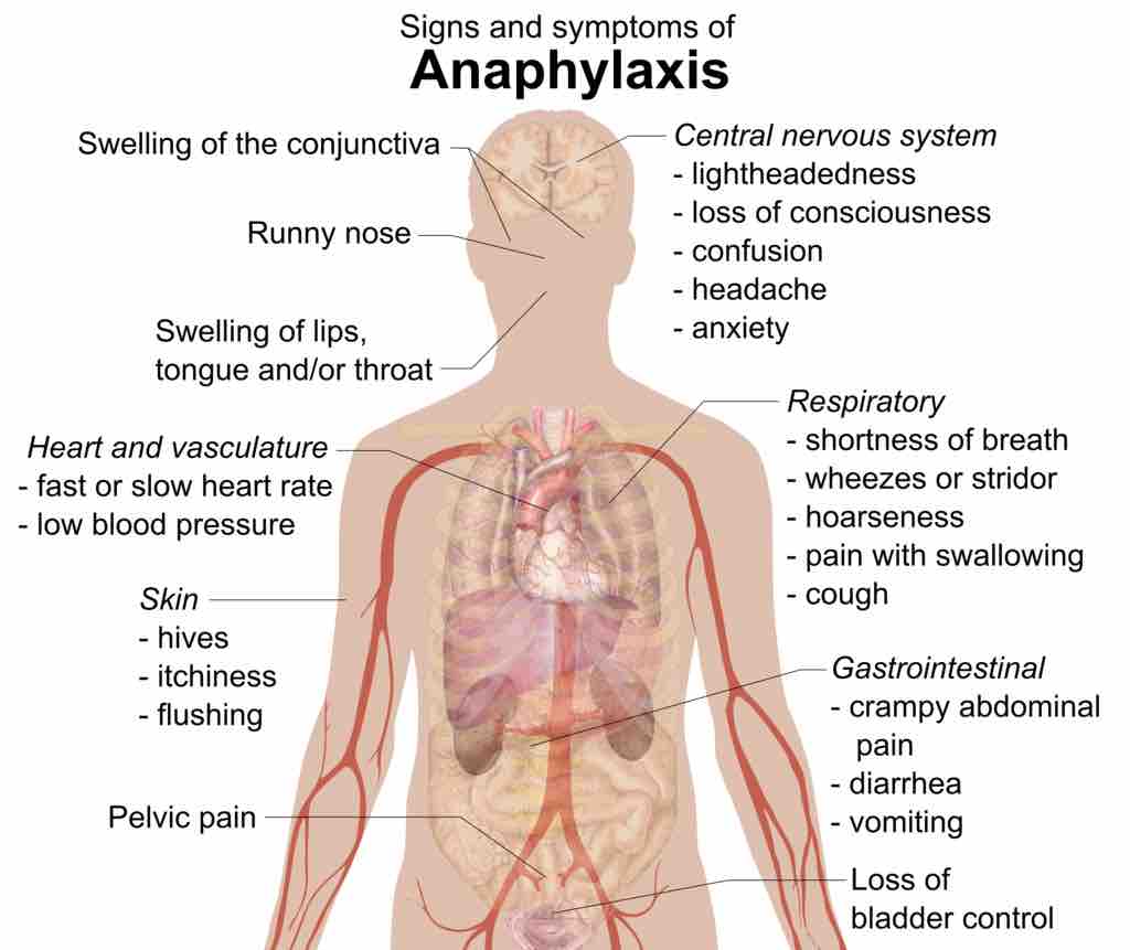 Anaphylaxis