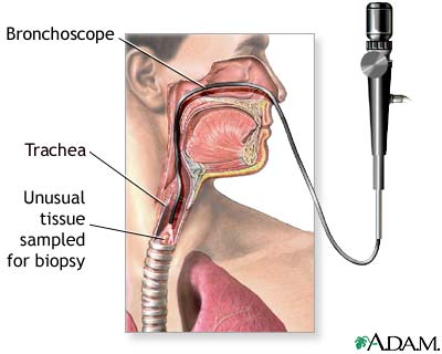 Upper airway test Upper airway test